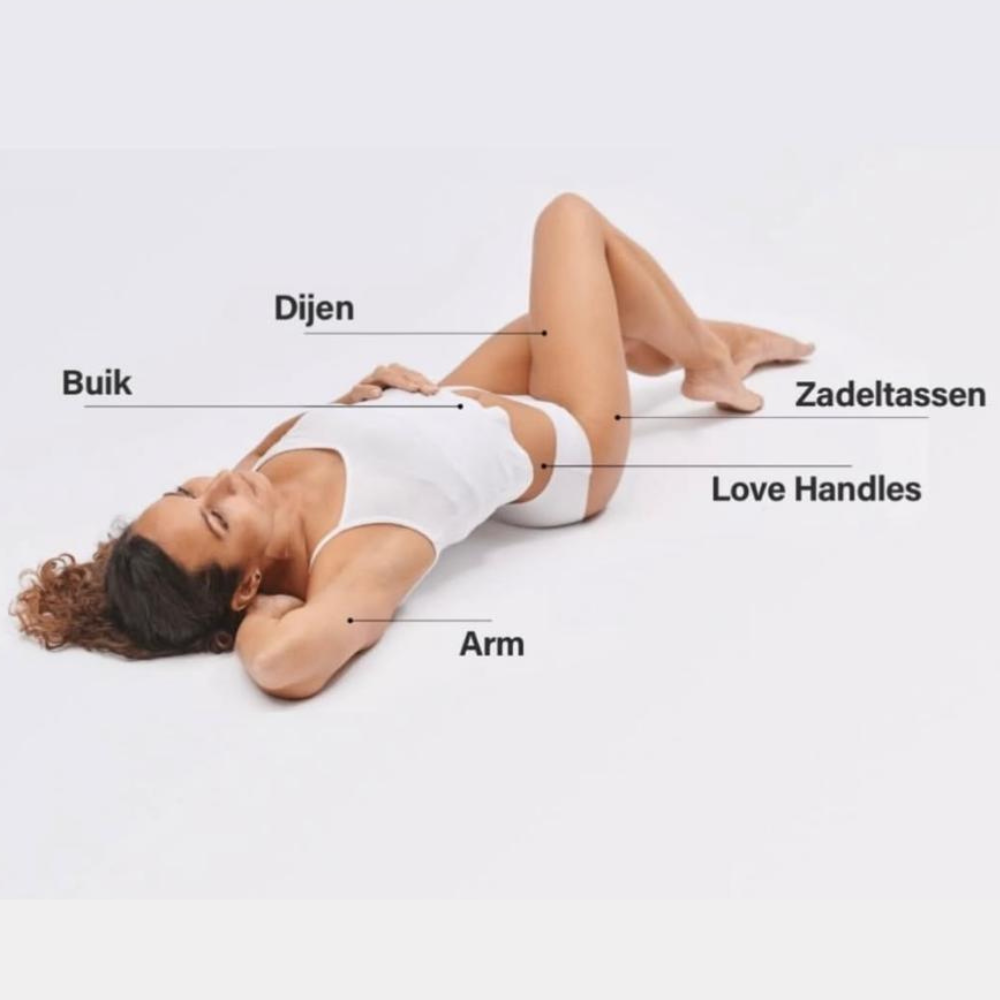 Coolsculpting behandelzones Antwerpen — buik, benen, armen, rug, kin