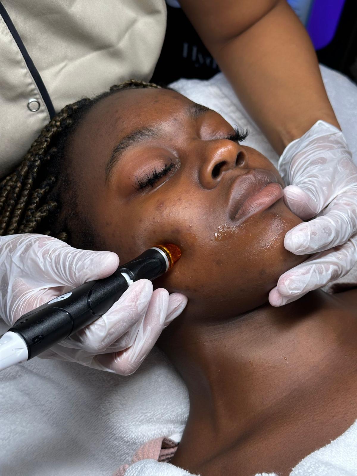 Cliënt tijdens HydraFacial behandeling in Antwerpen