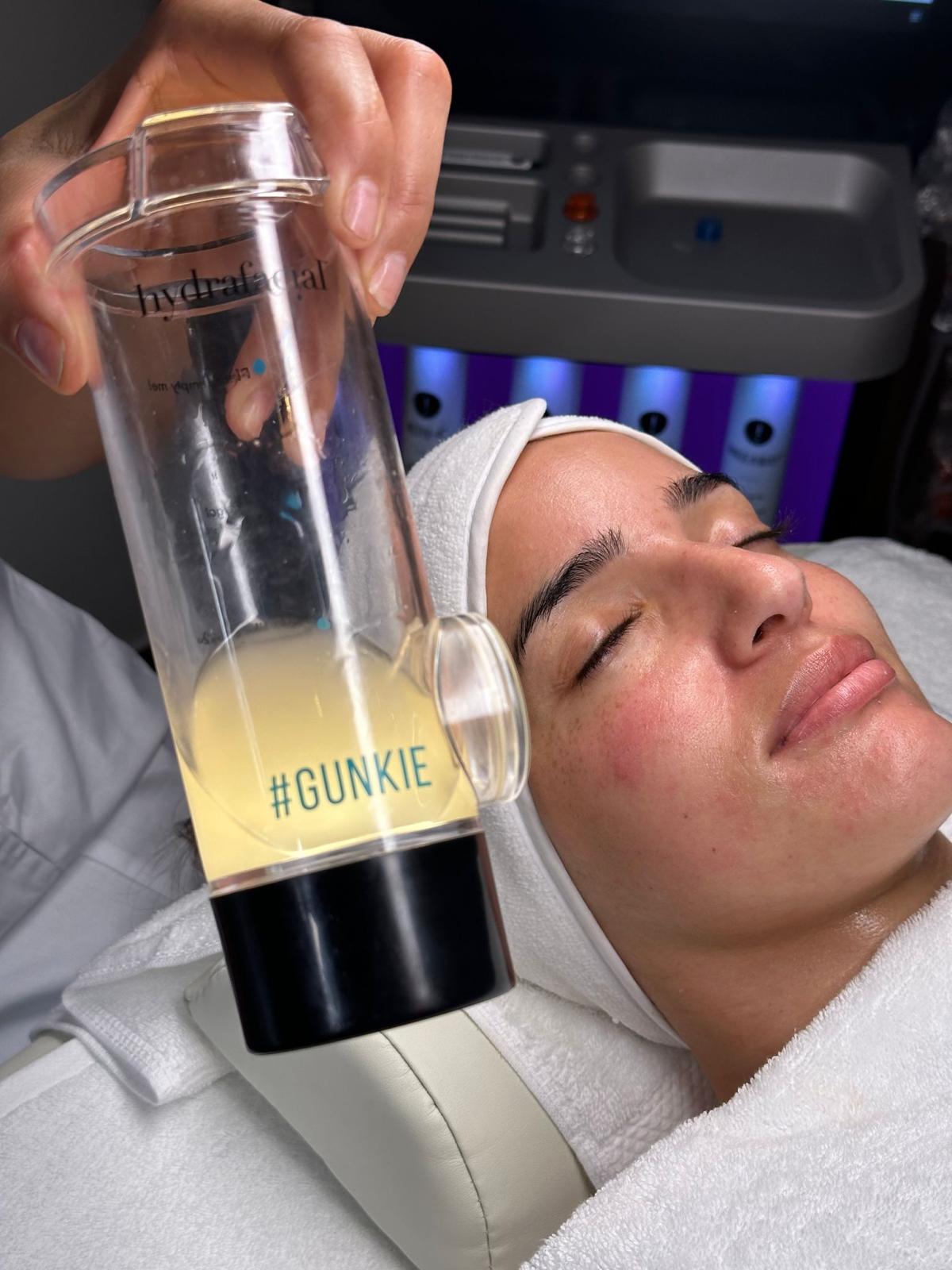 HydraFacial in Antwerpen met zichtbaar resultaat en glow