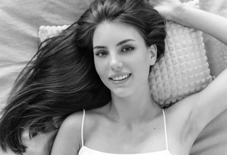 Microneedling Hair Loss Treatment Antwerpen